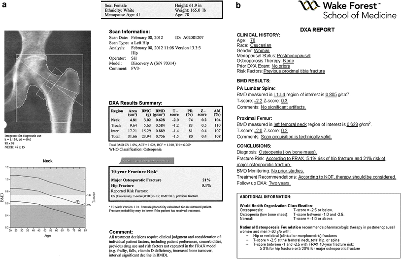 Use of FRAX® in DXA Interpretation Radiology Key