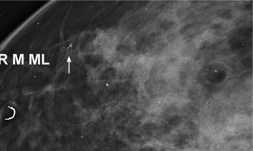 Difficult Cases Radiology Key