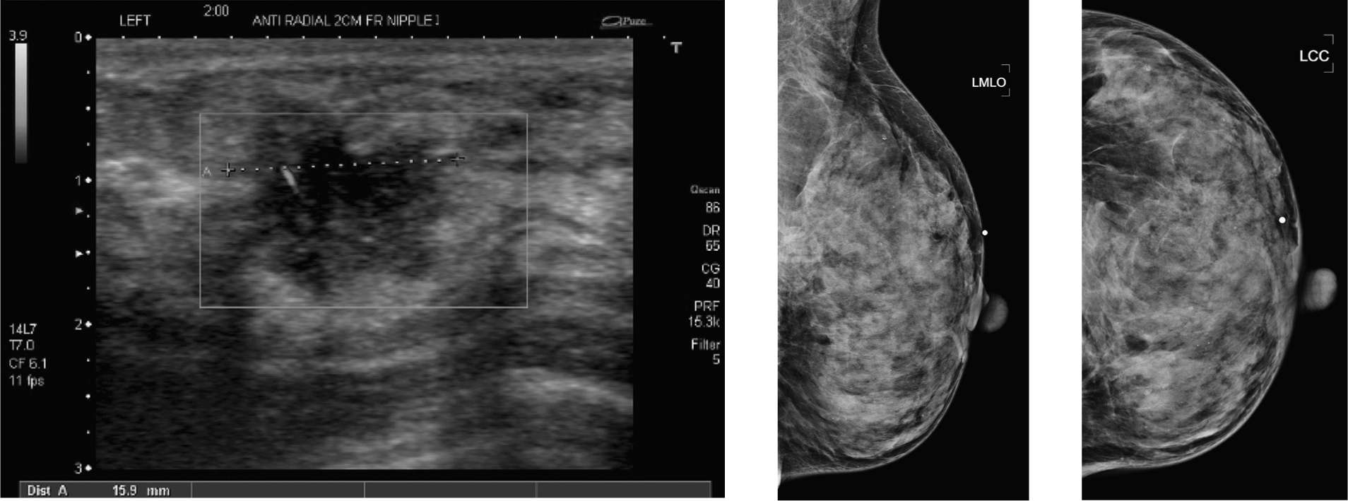 Difficult Cases Radiology Key