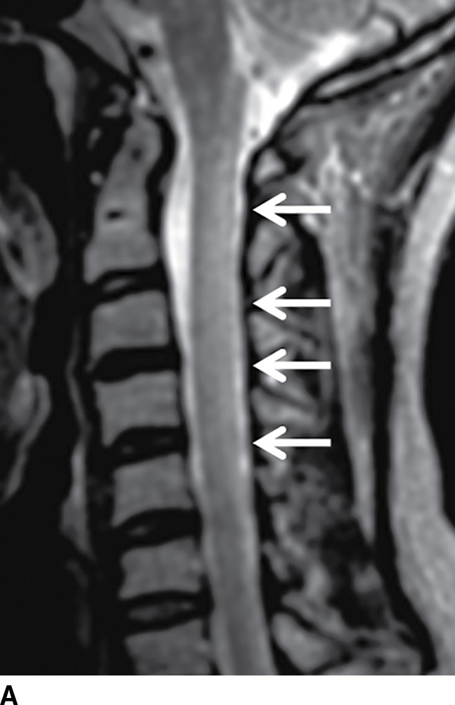 Approach to Mimics and LookAlikes Common Differential Diagnoses in
