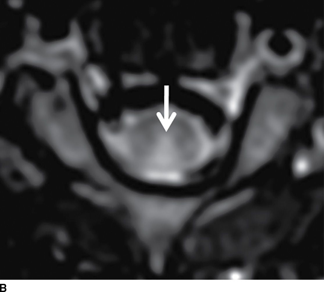 Approach to Mimics and LookAlikes Common Differential Diagnoses in
