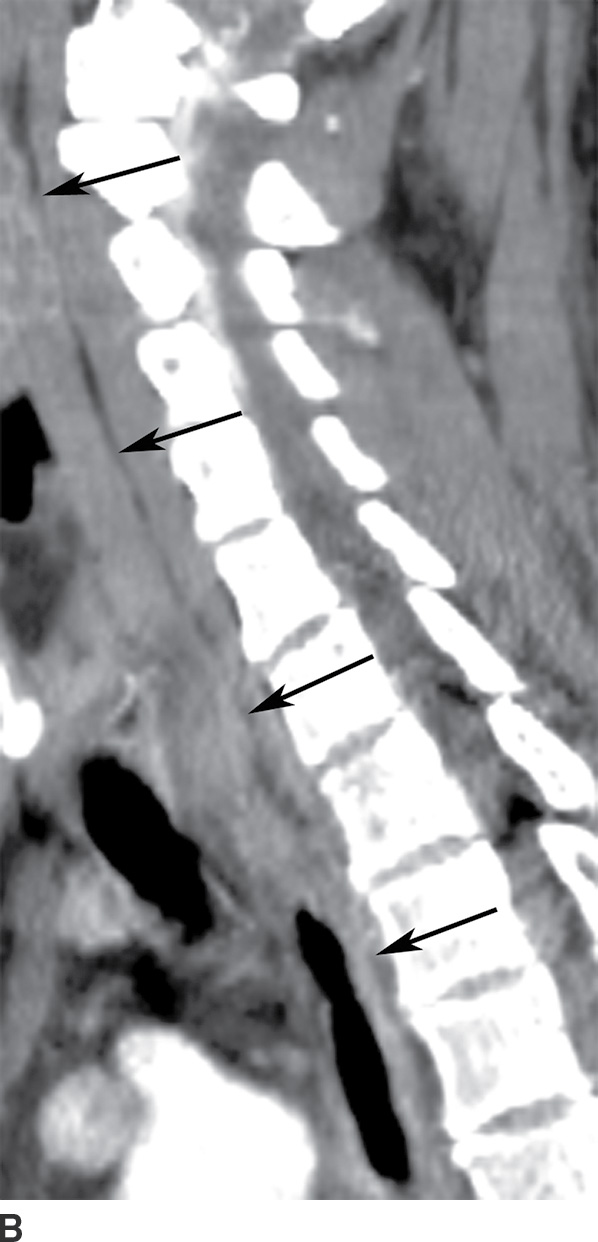 The Acute Neck Inflammation, Infections, and Trauma Radiology Key