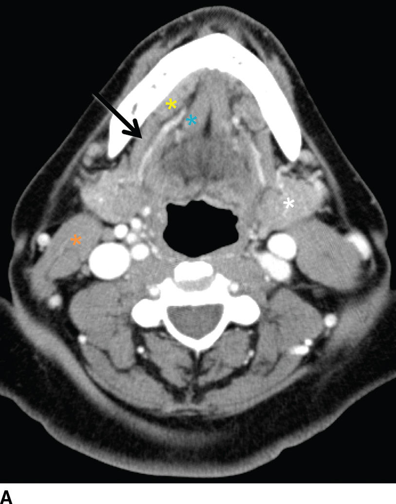 Anatomy Of The Salivary Glands