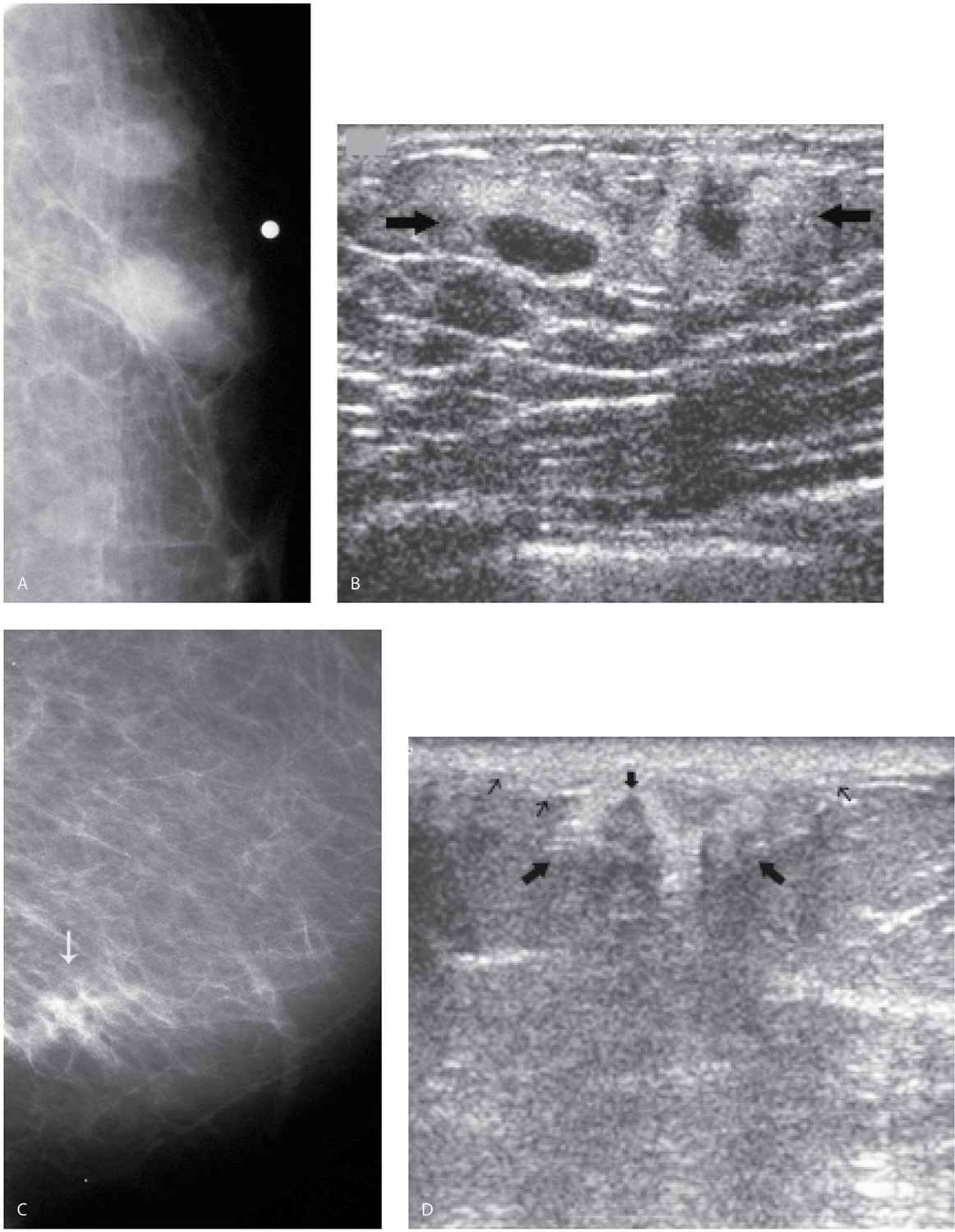 The Male Breast Radiology Key