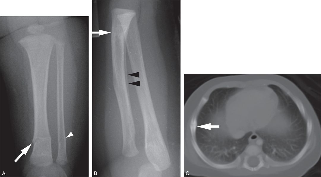 Differential diagnosis II disorders of calcium and phosphorus