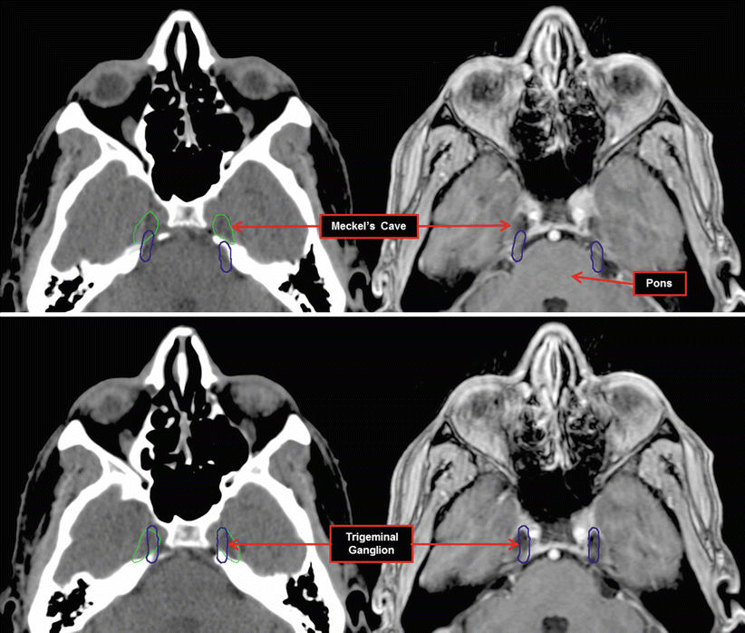Where Is Meckel's Cave Located at David Gerdes blog