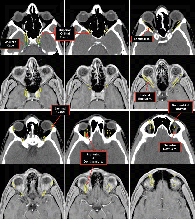 Nerves Radiology Key