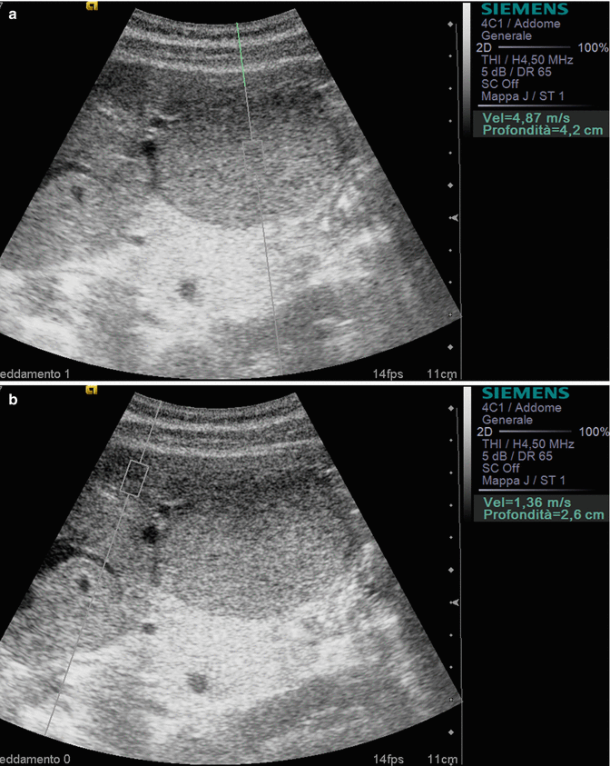 Liver and Spleen Radiology Key