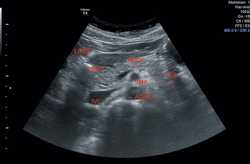 Pancreas Radiology Key