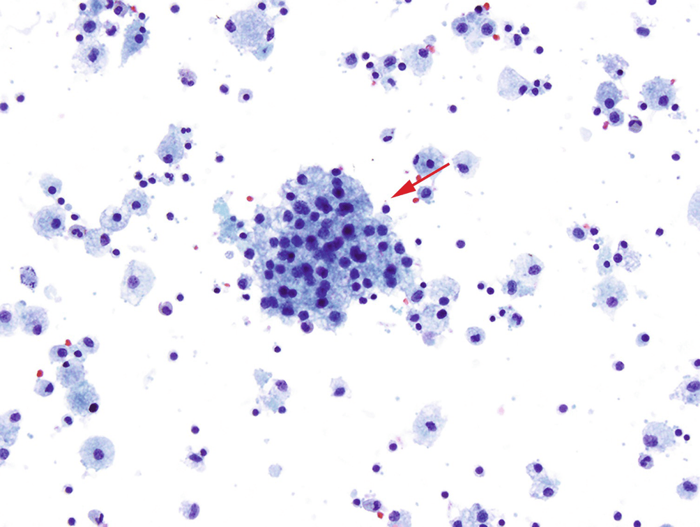 Como Que No Letra Significado