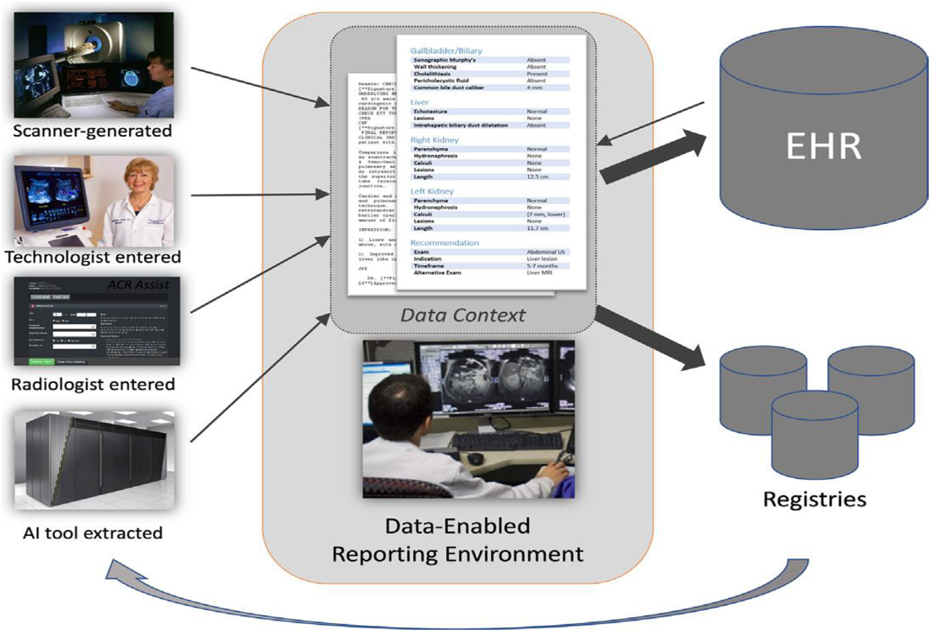 Artificial Intelligence Enabling Radiology Reporting Radiology Key