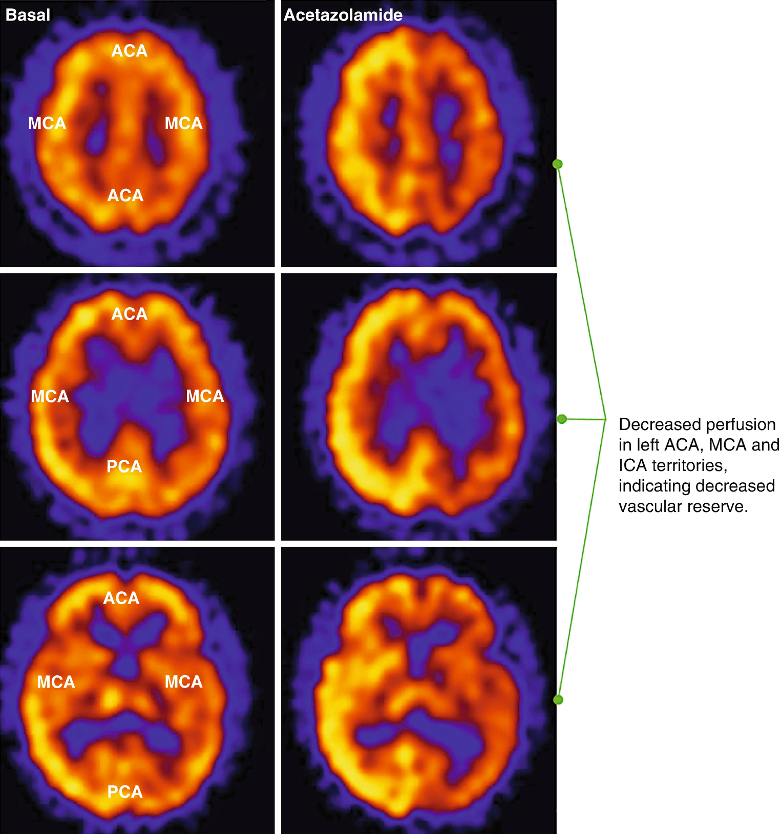 and Anatomy of SPECT/CT Radiology Key
