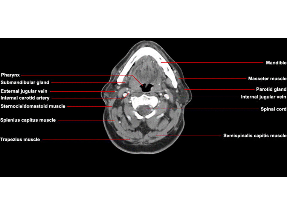 CT Neck Axial Anatomy