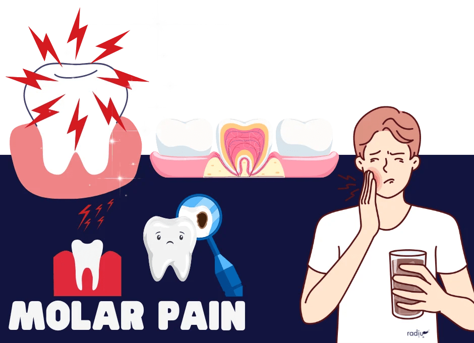 Molar Pain Causes and Relief