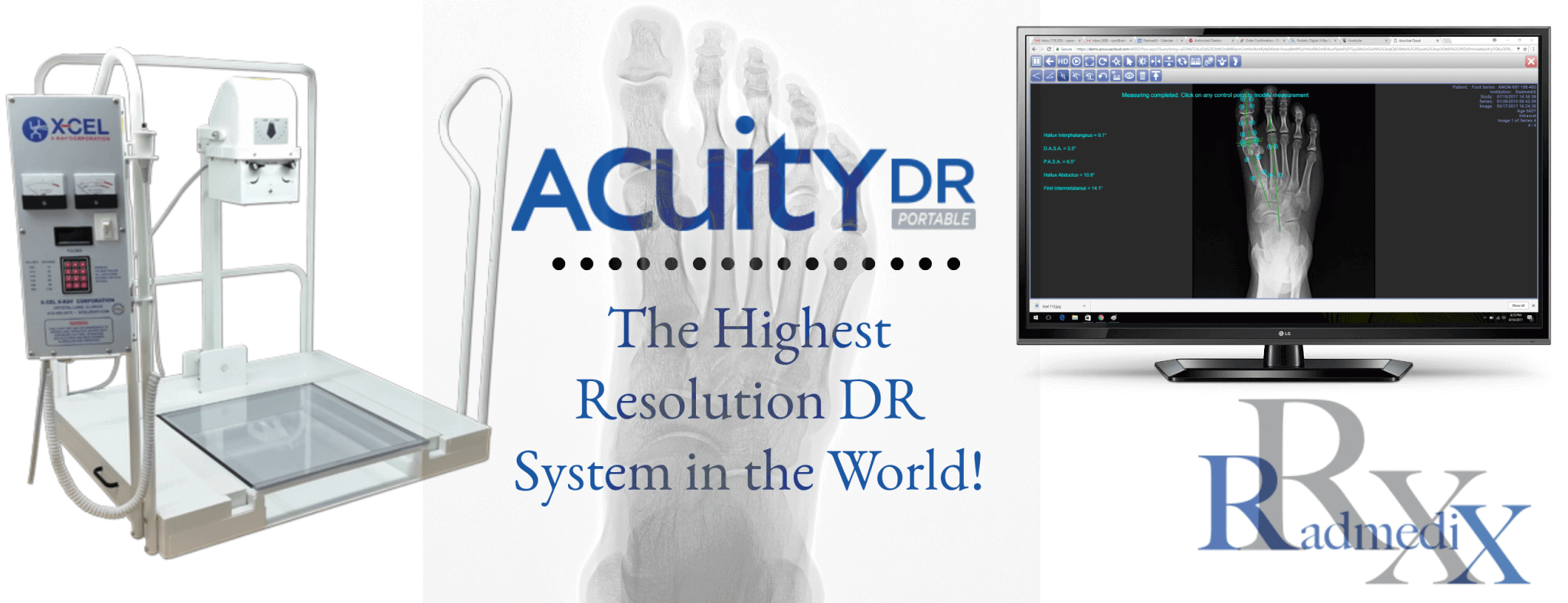 World's Highest Resolution Podiatry Digital XRay System Radmedix