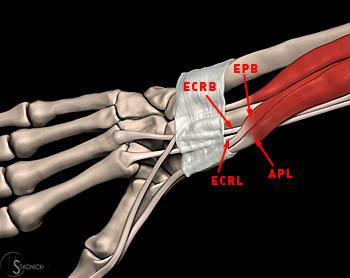 Tendon Intersection Syndromes - Radsource