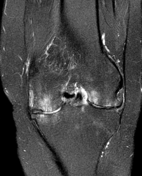 MR Imaging of Rheumatoid Arthritis Radsource