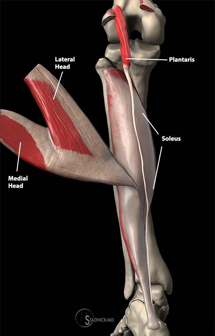 Not the Plantaris Keys to Better Diagnosis of Calf Strain Injuries