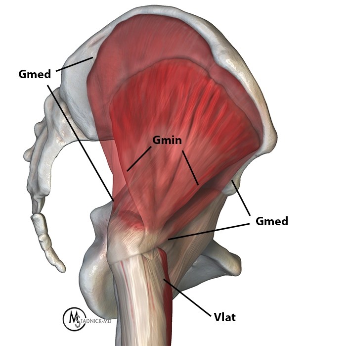 Gluteus Minimus Tendinopathy