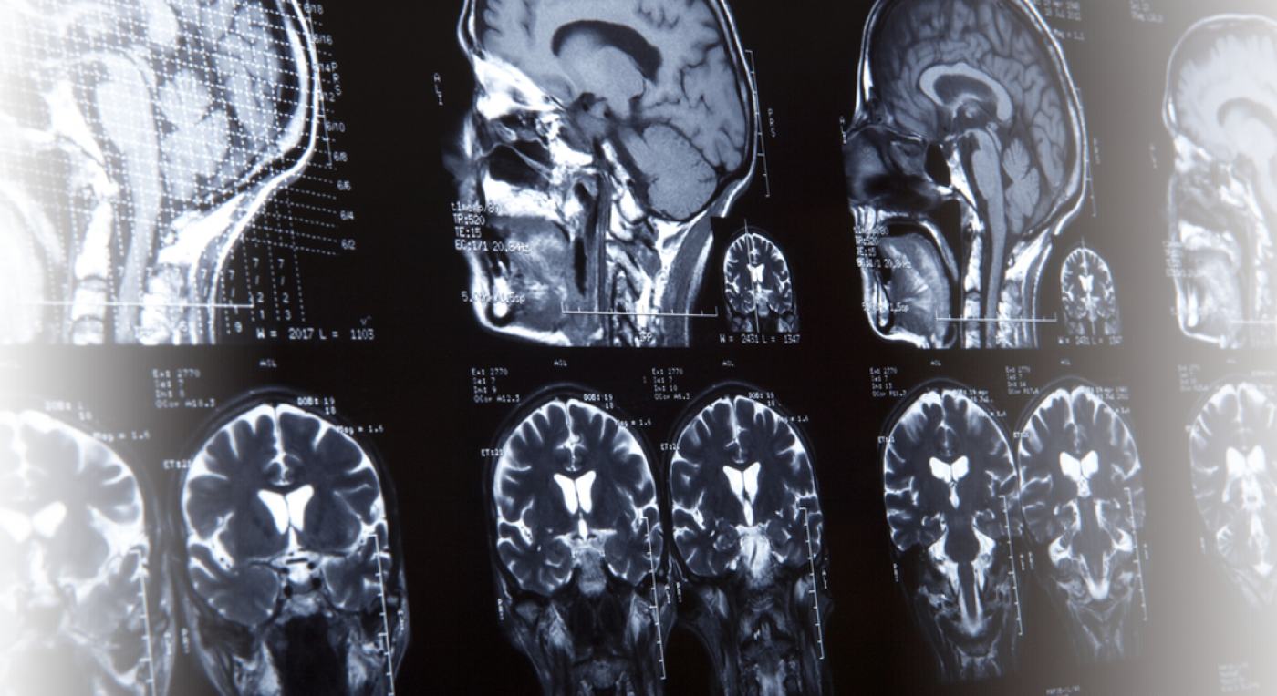 Dallas Personal Injury Lawyer Dallas Auto Accident Attorney