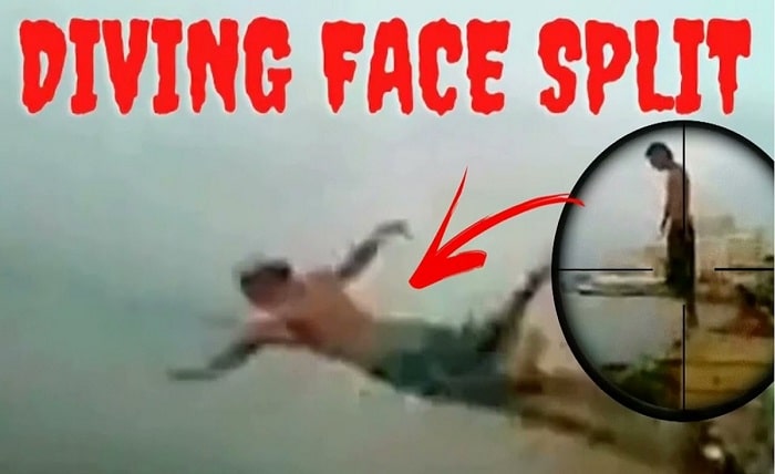 Split Face Diving Accident Guy My Projects