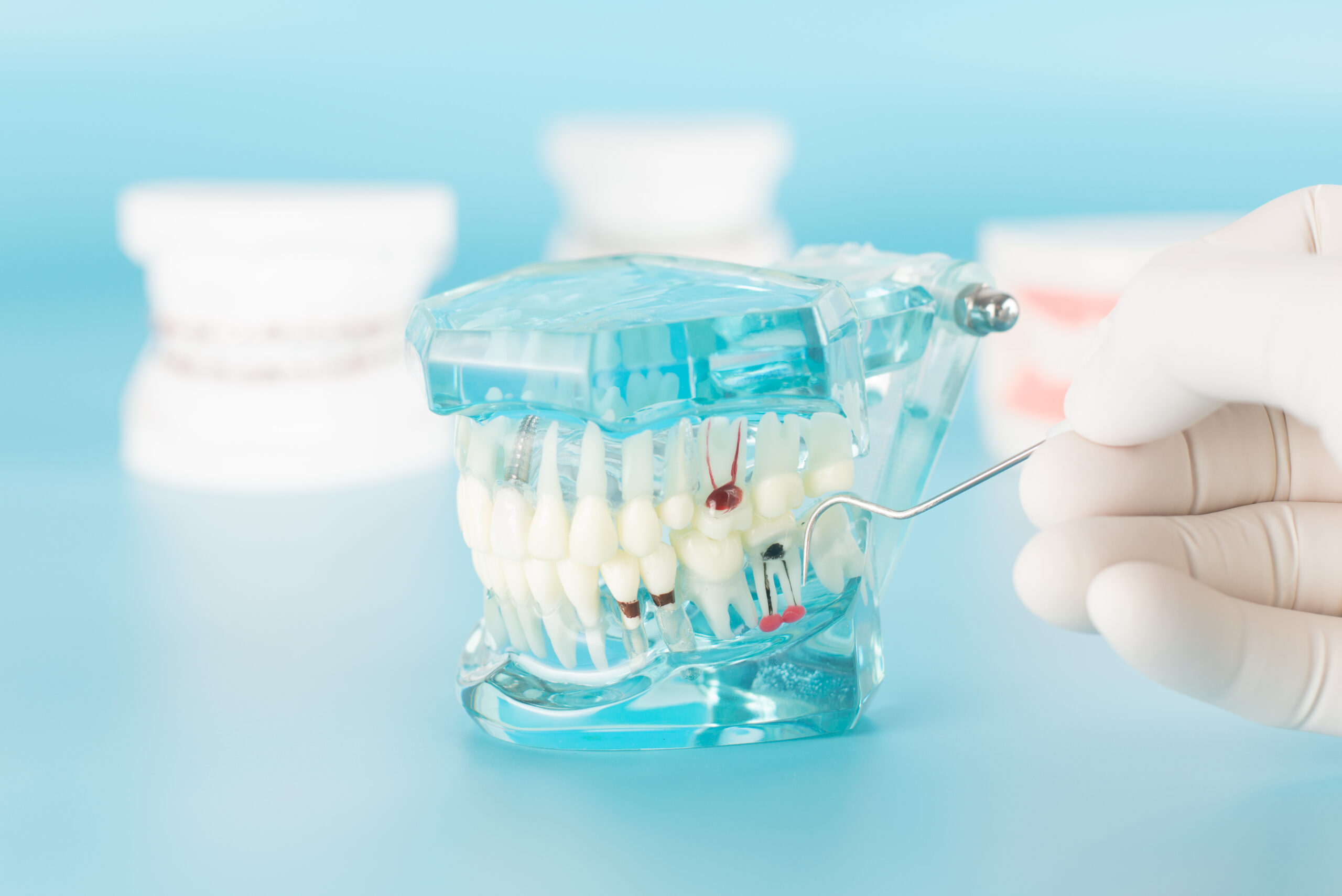 What Types of Procedures Do Endodontists Perform?