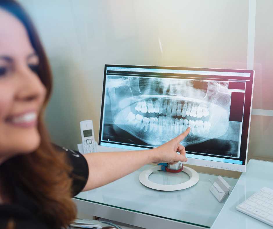 Orthodontic XRays in Perfecting Your Smile Randall Orthodontics