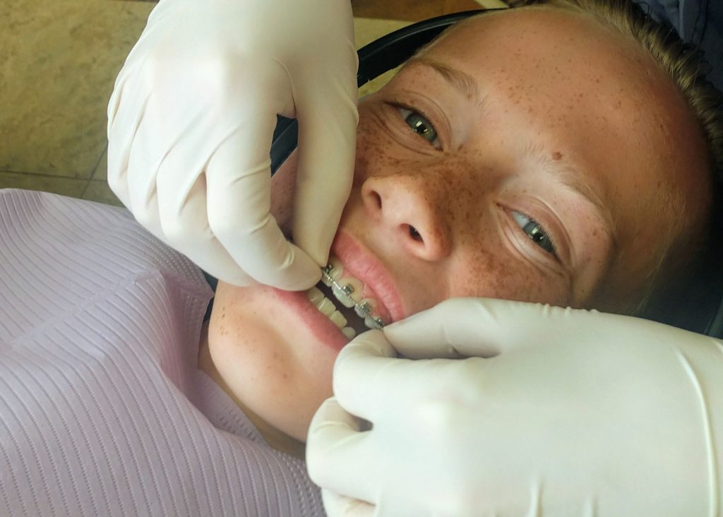 Orthodontic Expenses What Braces Cost Randall Orthodontics