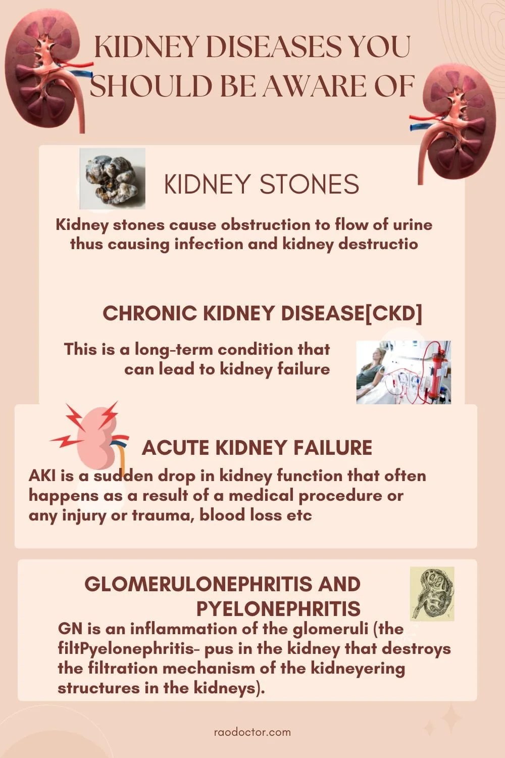 Kidney DiseaseHow To Prevent And Manage It
