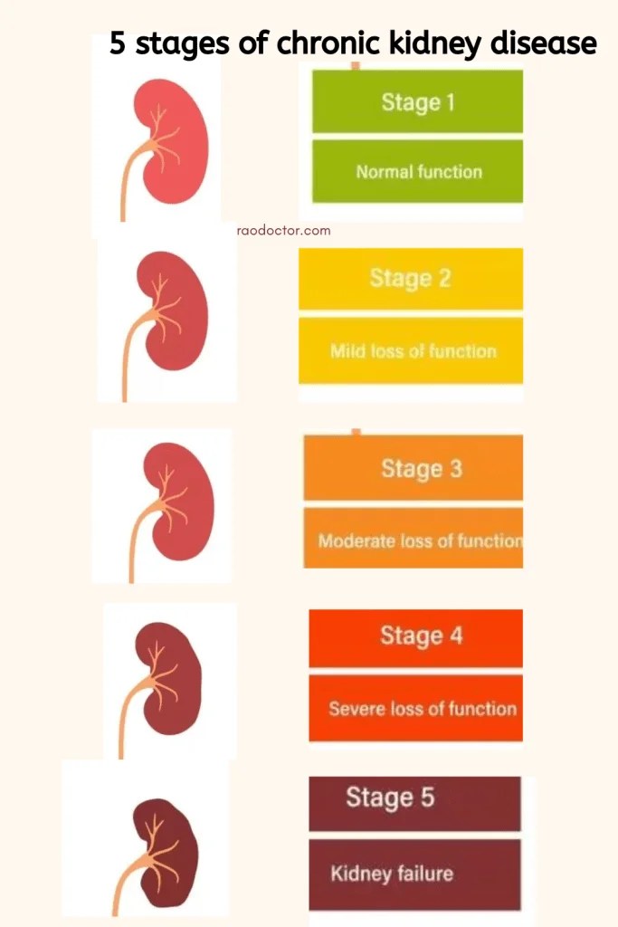 What You Need To Know About Chronic Kidney Disease Patientparadise