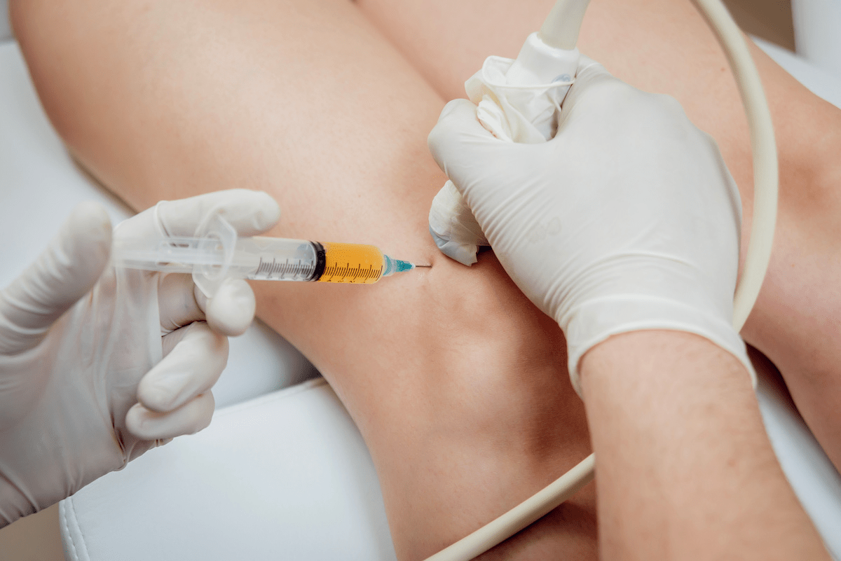 Using Guided Epidural and SJ Therapies to Gain Relief from Pain