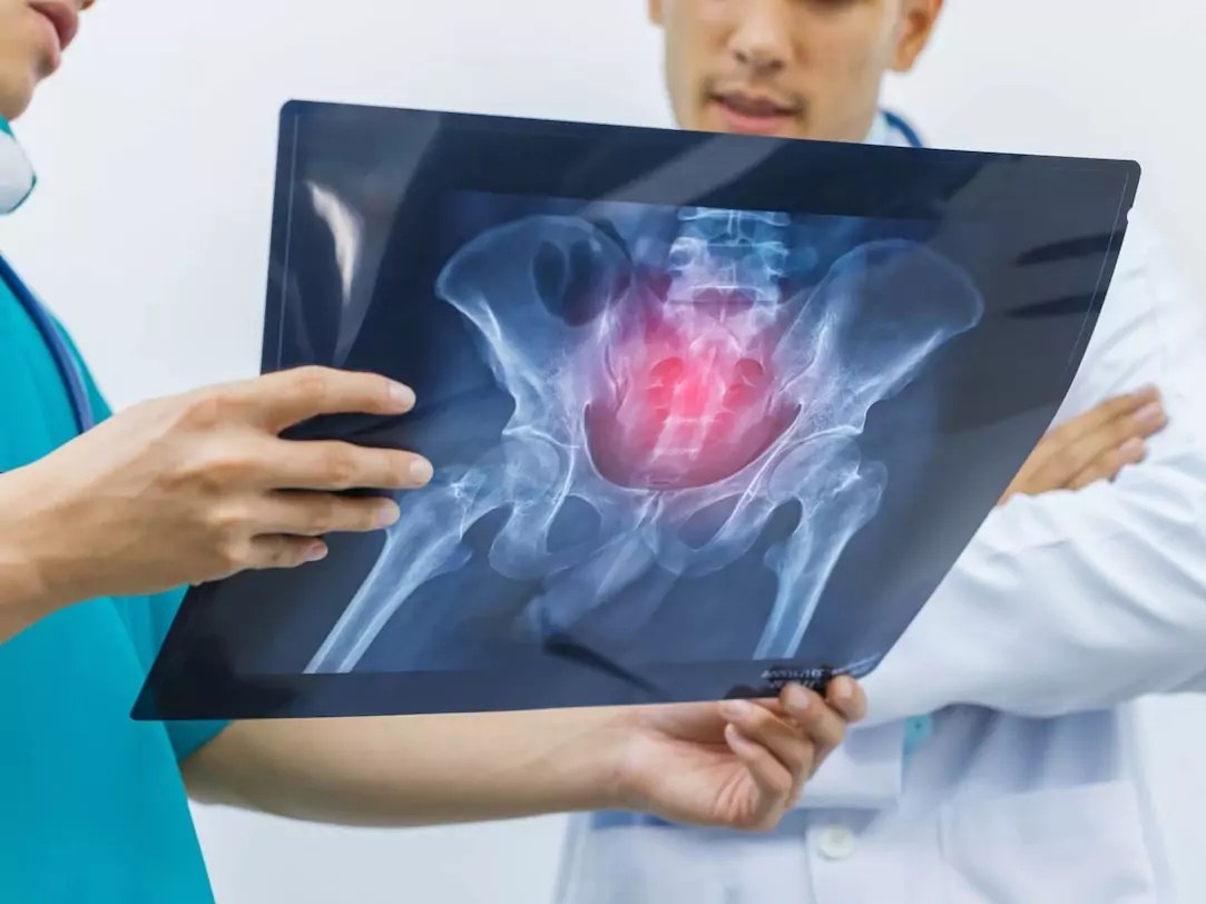 Using Guided Epidural and SJ Therapies to Gain Relief from Pain