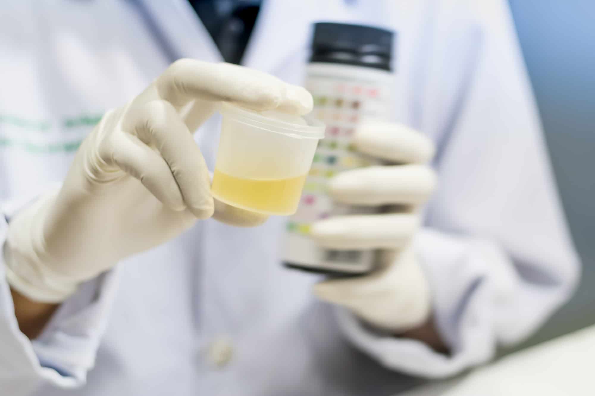Urine Drug Test Detection Times Rapid Detect Inc.