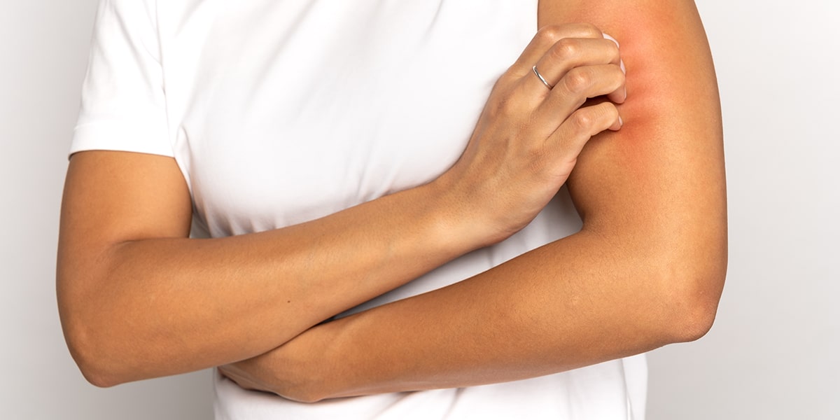 STDs That Cause Dry, Flaky Skin Itchy Skin And STIs