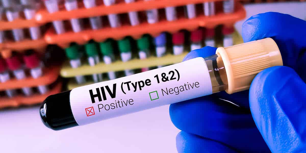 Can Undetectable HIV Detectable? Know The Facts