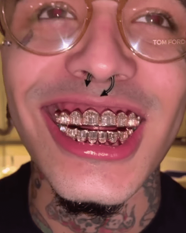 12 Most Expensive Teeth Grillz in the World