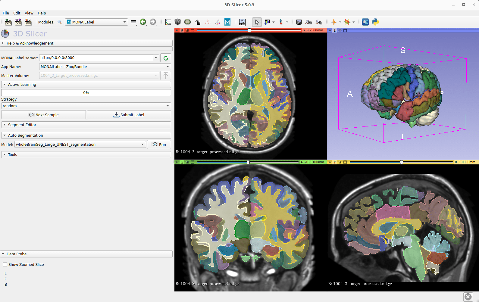 Brain MRI Segmentation AI Models