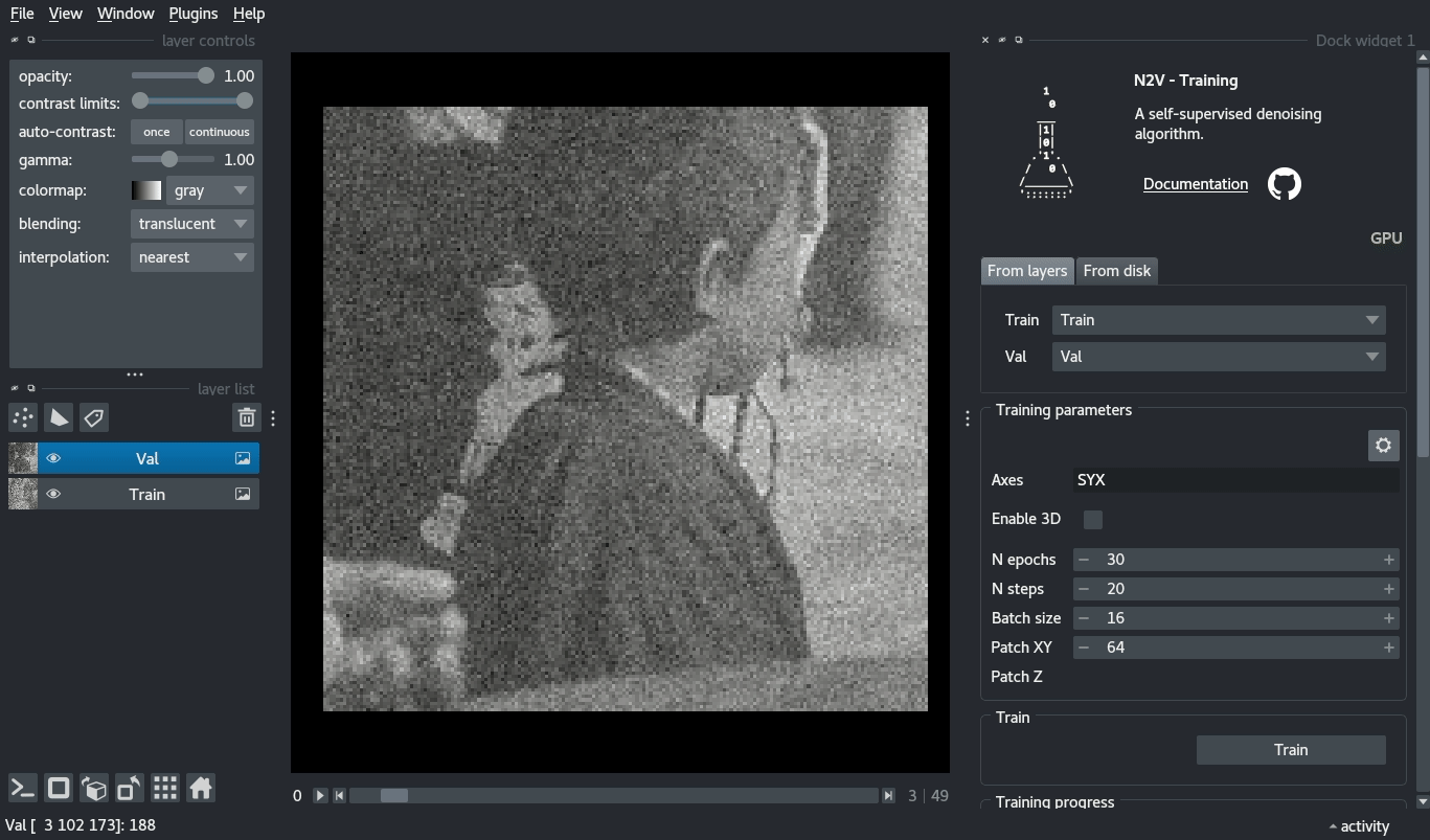 naparin2v A selfsupervised denoising algorithm. Home Installation