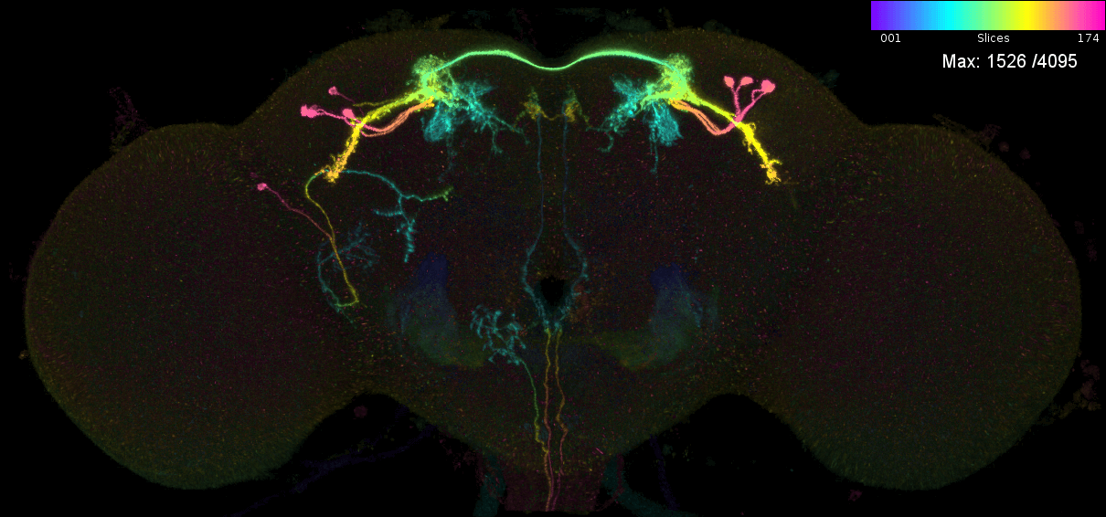 R client utilities for interacting with the NeuronBridge matching