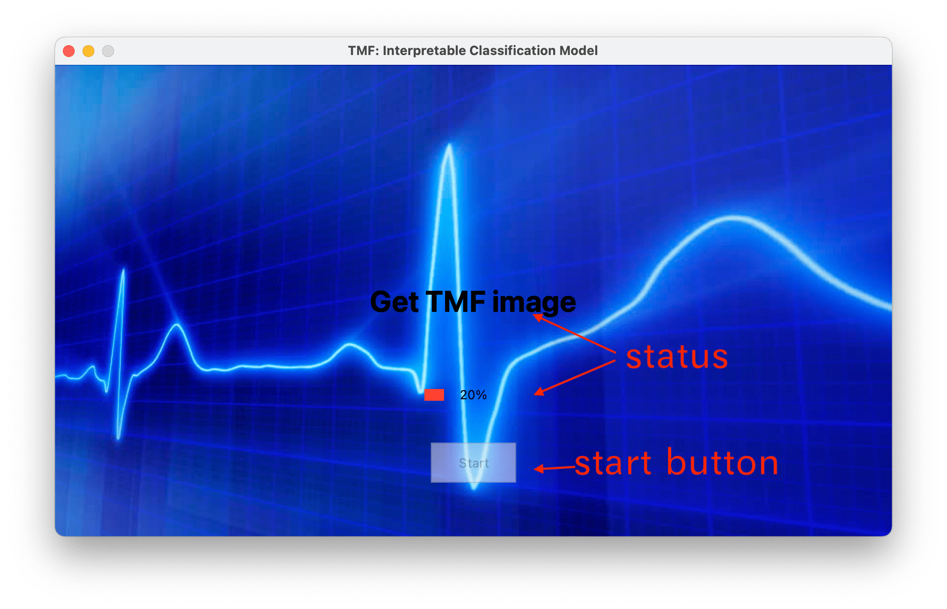 Atrial Fibrillation Detection AI牛丝