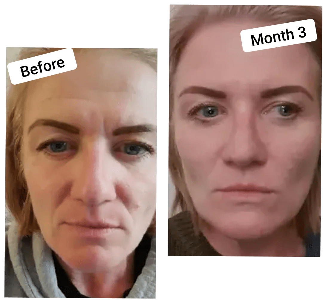 Get results Raw Beauty Lab