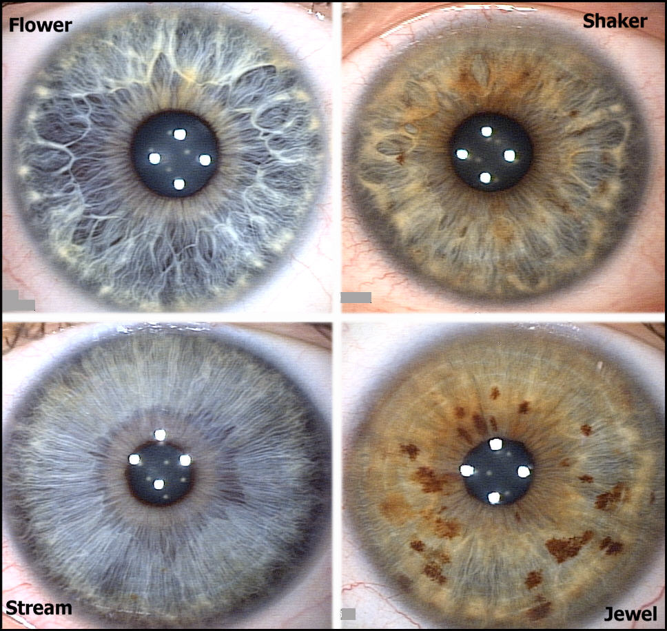 Iris Patterns/Structures Rayid
