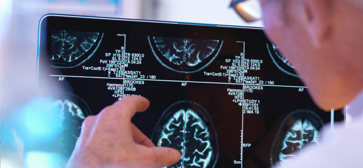 CDI is now RAYUS Radiology Experts in Quality Imaging