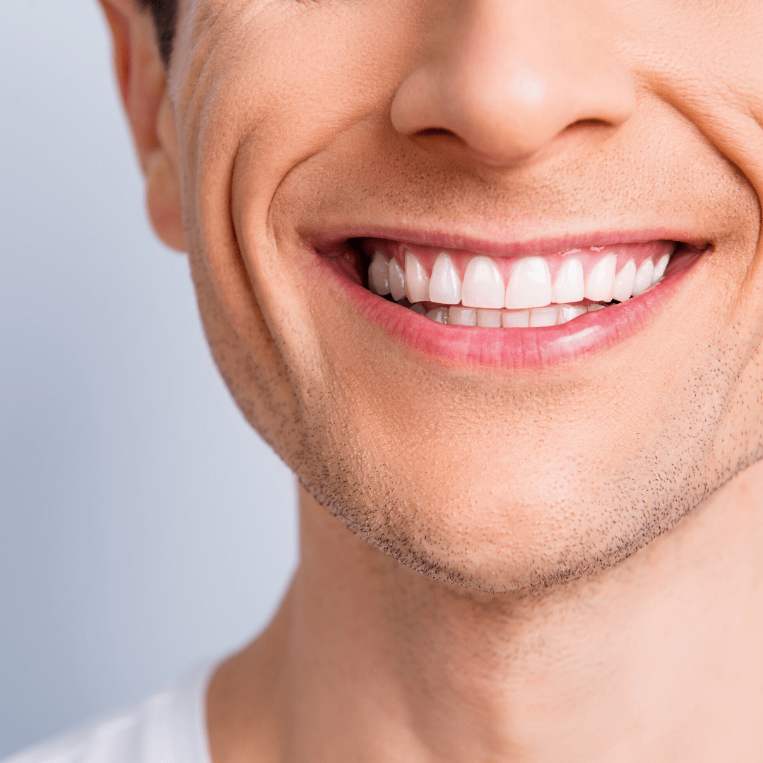 Is Teeth Whitening Bad For My Teeth?