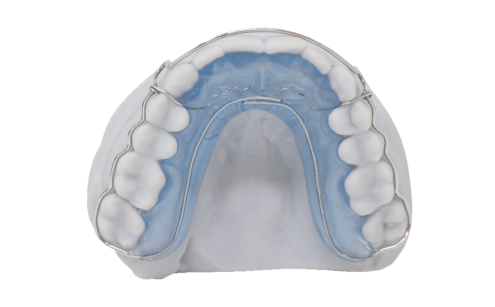 Modified Begg Retainer RDL Russellville Dental Lab