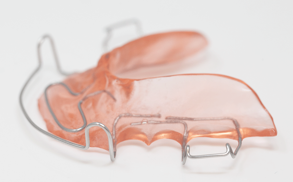 Spring Hawley Retainer RDL Russellville Dental Lab