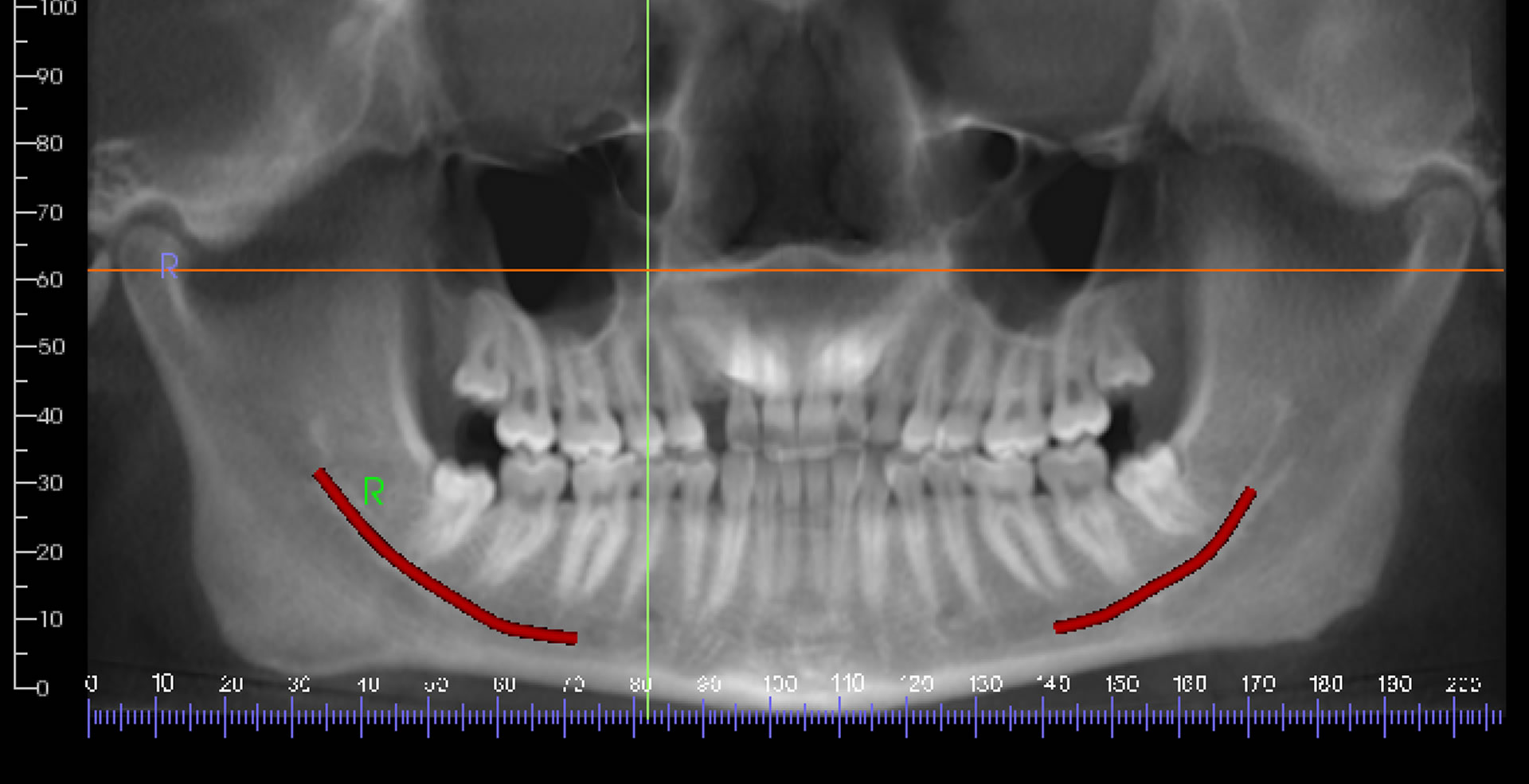 Dental and Maxillofacial Radiology Omaha