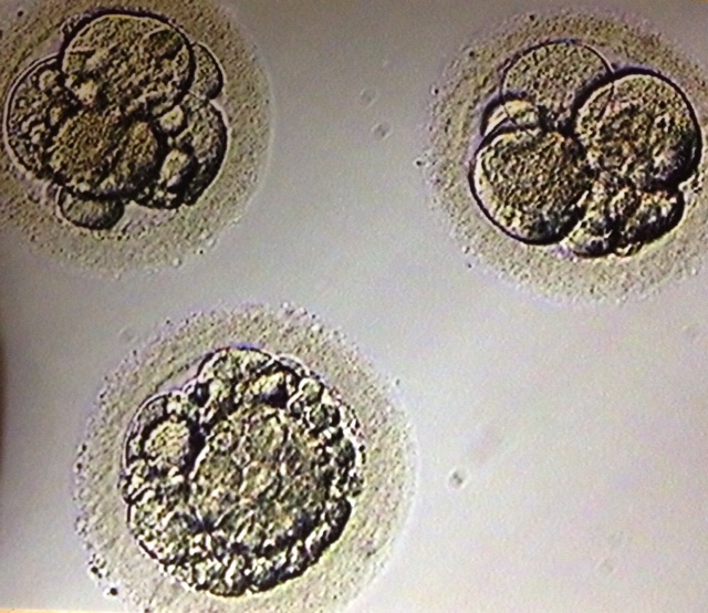 Embryo Transfer, Day 3 Reading Wildly