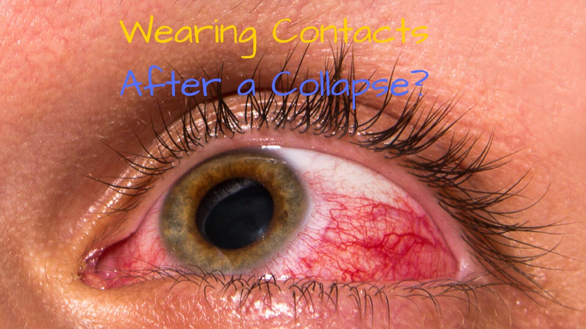 Can You Wear Contacts in a SHTF? What Are the Risks If