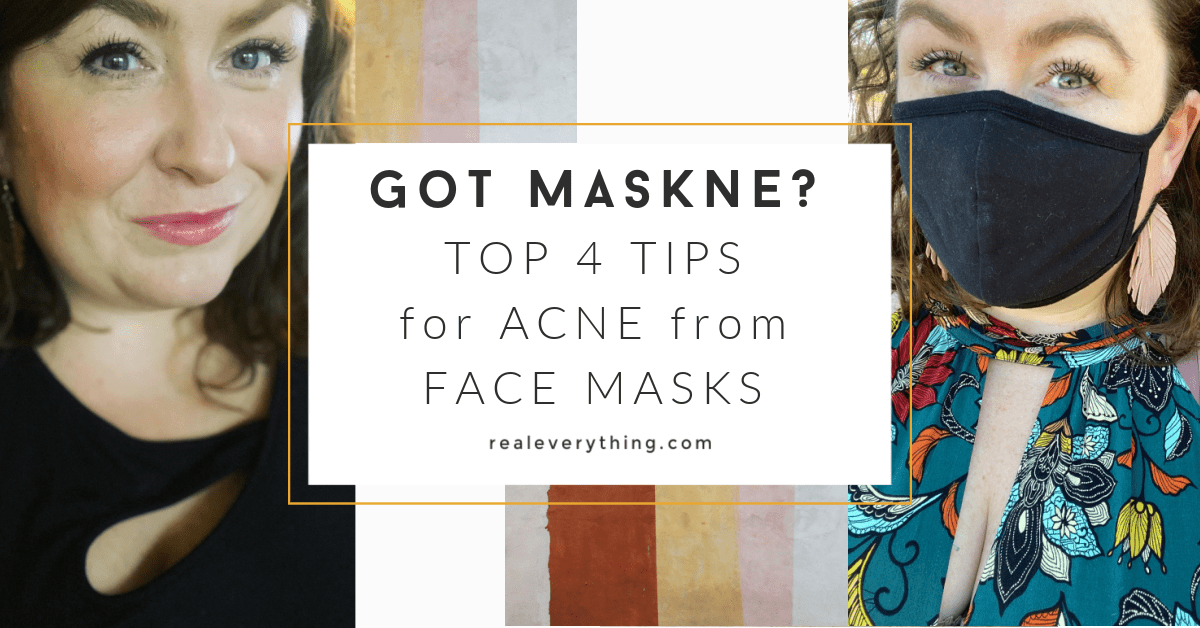 Got Maskne? NonToxic Tips for Acne from Face Masks Real Everything